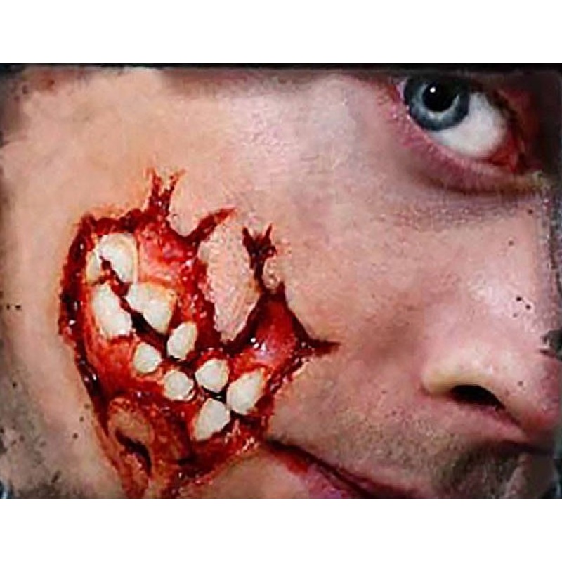 Self-adhesive 3D open jaw wound